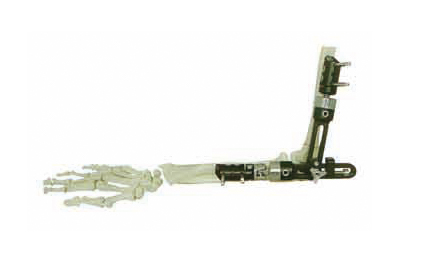 HM-10601肘关节系列